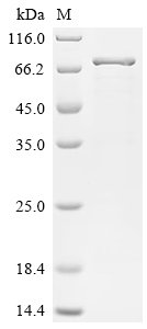 Human Drebrin-like protein (DBNL) Recombinant Protein, Homo sapiens (Human), E.coli, N-terminal 6xHis-SUMO-tagged, 61.1 kDa, purity >≥ 85% as determined by SDS-PAGE.