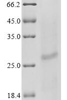 Human Sperm-egg fusion protein Juno (IZUMO1R) Recombinant Protein, N-His, aa 20–250, Baculovirus - BioCrest Sci