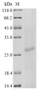 Human Sperm-egg fusion protein Juno (IZUMO1R) Recombinant Protein, N-His, aa 20–250, Baculovirus, Homo sapiens (Human), Baculovirus, N-terminal 6xHis-tagged, 27.4 kDa, purity >≥ 85% as determined by SDS-PAGE.