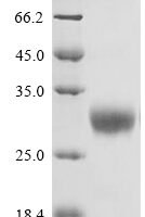 Macaca mulatta Uncharacterized protein (OSM) Recombinant Protein, C-His-Myc - BioCrest Sci