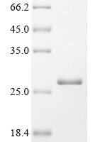 Physarum polycephalum Intron-encoded endonuclease I-PpoI Recombinant Protein - BioCrest Sci