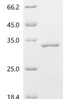 Human ADP-ribosylation factor-like protein 4D (ARL4D) Recombinant Protein - BioCrest Sci
