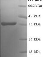 Human Bcl-2-like protein 2 (BCL2L2) Recombinant Protein - BioCrest Sci