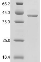 Mouse Cyclin-dependent-like kinase 5 (Cdk5) Recombinant Protein - BioCrest Sci
