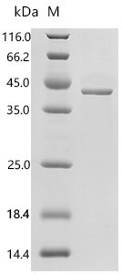 Mouse Cyclin-dependent-like kinase 5 (Cdk5) Recombinant Protein, Mus musculus (Mouse), E.coli, C-terminal 6xHis-tagged, 40.2 kDa, purity >≥ 85% as determined by SDS-PAGE.