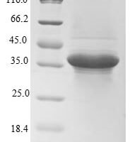 Human Transgelin-2 (TAGLN2) Recombinant Protein - BioCrest Sci