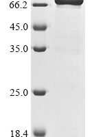 Escherichia coli Penicillin-binding protein 1A (mrcA), partial,Biotinylated Recombinant Protein - BioCrest Sci