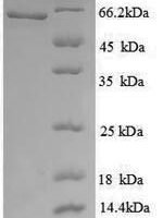 Human Histone acetyltransferase KAT5 (KAT5), partial Recombinant Protein - BioCrest Sci