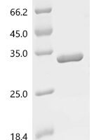 Staphylococcus aureus ATP-dependent Clp protease proteolytic subunit (clpP) Recombinant Protein - BioCrest Sci