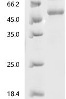 Human Interleukin-33 (IL33), partial Recombinant Protein, N-hFc1 - BioCrest Sci