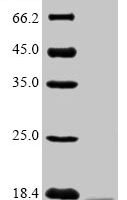 Human immunodeficiency virus type 2 subtype A Protein Vpx (vpx) Recombinant Protein, N-His-Myc - BioCrest Sci