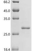 Human herpesvirus 4 Capsid scaffolding protein (BVRF2/BdRF1), partial Recombinant Protein - BioCrest Sci