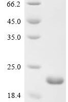 Salmonella typhimurium SPI-1 type 3 secretion system translocon protein SctE (sctE1), partial Recombinant Protein - BioCrest Sci