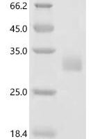 Human Neuronal acetylcholine receptor subunit alpha-9 (CHRNA9), partial Recombinant Protein, N-10His-Avi - BioCrest Sci