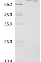 Human Polyunsaturated fatty acid 5-lipoxygenase (ALOX5) Recombinant Protein, C-His - BioCrest Sci