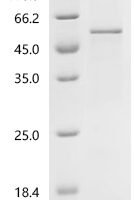 Human Protein Wnt-10a (WNT10A) Recombinant Protein, C-His - BioCrest Sci
