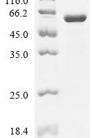 Escherichia coli Cysteine--tRNA ligase (cysS) Recombinant Protein - BioCrest Sci