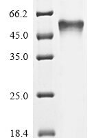 Escherichia coli Bifunctional protein GlmU (glmU) Recombinant Protein, N-His - BioCrest Sci