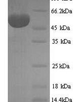 Human Hexokinase-1 (HK1), partial Recombinant Protein, N-His, aa 13–475, Yeast - BioCrest Sci