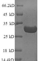 Arabidopsis thaliana Chorismate mutase, chloroplastic (CM1), partial Recombinant Protein - BioCrest Sci
