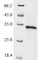 Human Extracellular serine/threonine protein kinase FAM20C (FAM20C), partial Recombinant Protein - BioCrest Sci