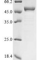 Mycobacterium bovis 4-aminobutyrate aminotransferase (gabT) Recombinant Protein - BioCrest Sci