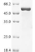 Chicken Growth/differentiation factor 9 (GDF-9) Recombinant Protein - BioCrest Sci