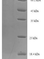 Human Sorting nexin-1 (SNX1) Recombinant Protein - BioCrest Sci