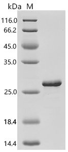 Human Eukaryotic translation initiation factor 1A, Y-chromosomal (EIF1AY) Recombinant Protein, C-His, Homo sapiens (Human), E.coli, C-terminal 6xHis-tagged, 23.2 kDa, purity >≥ 90% as determined by SDS-PAGE.