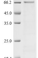 Human SET and MYND domain-containing protein 3 (SMYD3) Recombinant Protein - BioCrest Sci