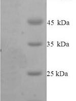 Mouse Elongation factor 2 (Eef2) Recombinant Protein, N-10His/C-Myc, aa 2–858, Yeast - BioCrest Sci