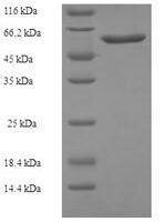 Escherichia coli Ribonucleoside-diphosphate reductase 1 subunit beta (nrdB) Recombinant Protein, N-His-SUMO - BioCrest Sci