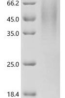 Mouse Mucolipin-1 (Mcoln1), partial Recombinant Protein - BioCrest Sci