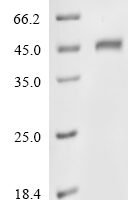 Human Trypsin-2 (PRSS2) (K23Q,S167G), partial Recombinant Protein - BioCrest Sci
