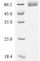 Mouse Prosaposin (Psap)(N459Q) Recombinant Protein - BioCrest Sci