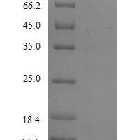 Human Secreted Ly-6/uPAR-related protein 1 (SLURP1) Recombinant Protein, Tag-Free - BioCrest Sci