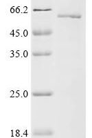 Human Aryl hydrocarbon receptor (AHR) , partial Recombinant Protein - BioCrest Sci