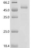 Human CMRF35-like molecule 1 (CD300LF) (E111A,D116A,W52A), partial Recombinant Protein - BioCrest Sci