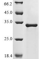 Human NPC intracellular cholesterol transporter 1 (NPC1), partial Recombinant Protein - BioCrest Sci