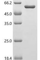Human cAMP-dependent protein kinase type I-alpha regulatory subunit (PRKAR1A) Recombinant Protein - BioCrest Sci