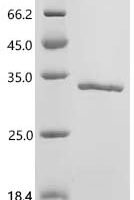 Human Glutathione S-transferase Mu 3 (GSTM3) Recombinant Protein - BioCrest Sci