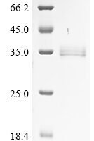 Bacillus cereus 1-phosphatidylinositol phosphodiesterase Recombinant Protein - BioCrest Sci