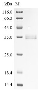 Bacillus cereus 1-phosphatidylinositol phosphodiesterase Recombinant Protein, Bacillus cereus, Yeast, C-terminal 6xHis-tagged, 36.0 kDa, purity >≥ 90% as determined by SDS-PAGE.