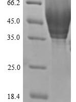 Human CD63 antigen (CD63), partial Recombinant Protein, N-His-SUMOstar - BioCrest Sci