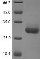 Mouse 14-3-3 protein beta/alpha (Ywhab) Recombinant Protein, N-10His - BioCrest Sci