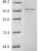 Drosophila melanogaster Stress-activated protein kinase JNK (bsk) Recombinant Protein, N-His - BioCrest Sci