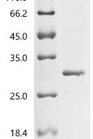 Macaca mulatta Somatotropin (GH1) Recombinant Protein - BioCrest Sci