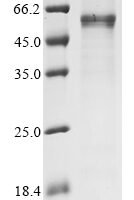 Human Cellular tumor antigen p53 (TP53) (R175H) Recombinant Protein - BioCrest Sci