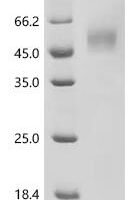 Reston ebolavirus Pre-small/secreted glycoprotein (GP), partial Recombinant Protein, N-His, aa 34–325, Mammalian cell - BioCrest Sci