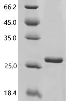 Sheep Granulocyte-macrophage colony-stimulating factor (CSF2) Recombinant Protein - BioCrest Sci